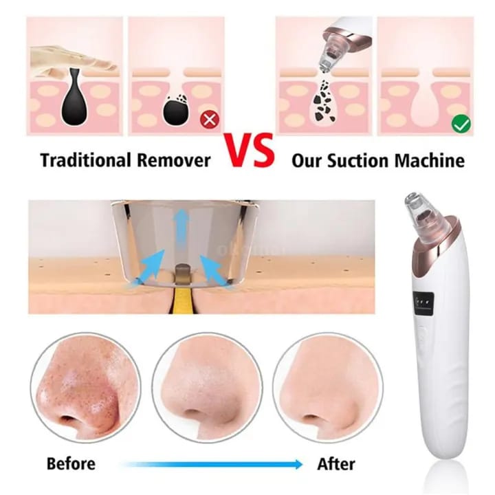Multifunctional Electric Facial Pore Cleaner & Blackhead Remover