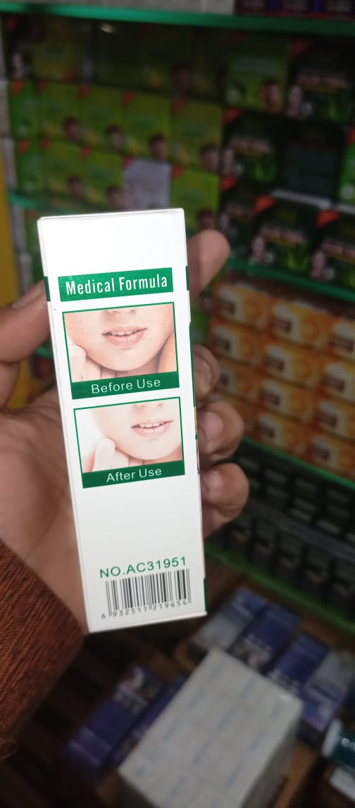 Aichun Beauty Anti-Freckle Whitening Facial Serum